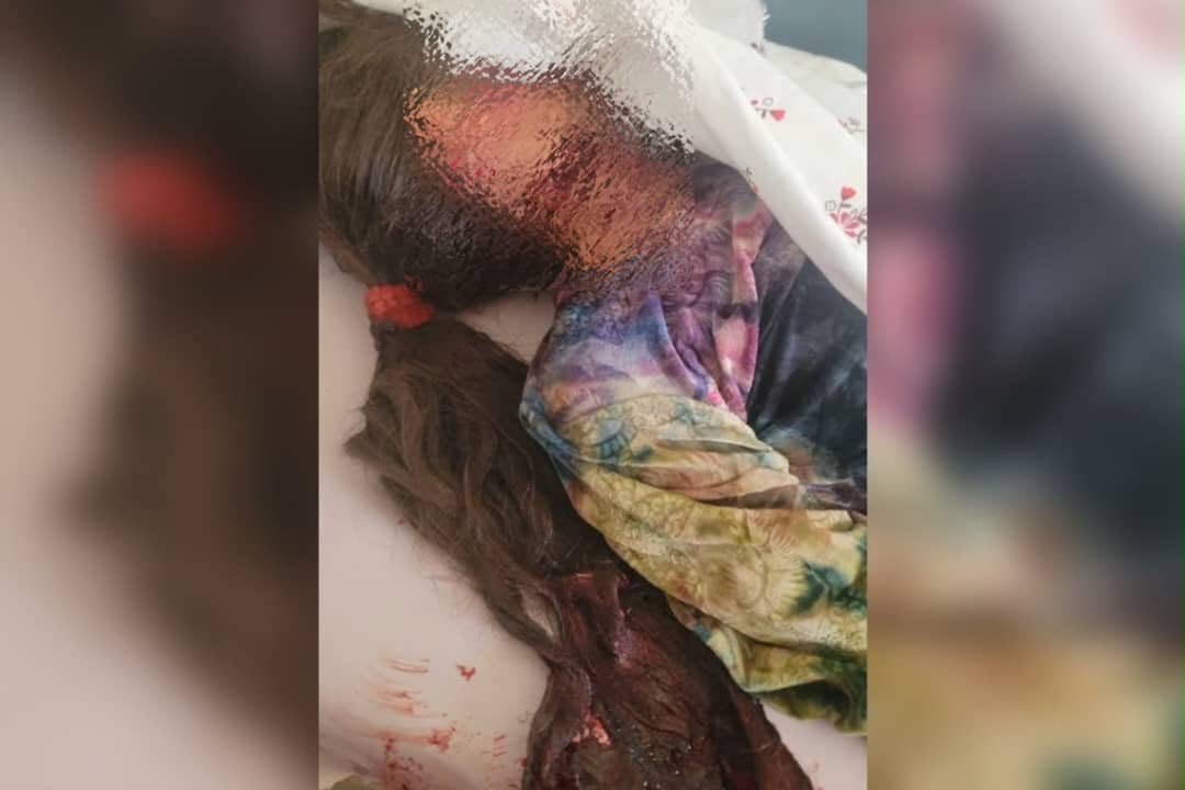یک&zwnj; دختر ۱۱ ساله در سرپل پس از تجاوز به&zwnj;شکل فجیع کُشته شده&zwnj;است