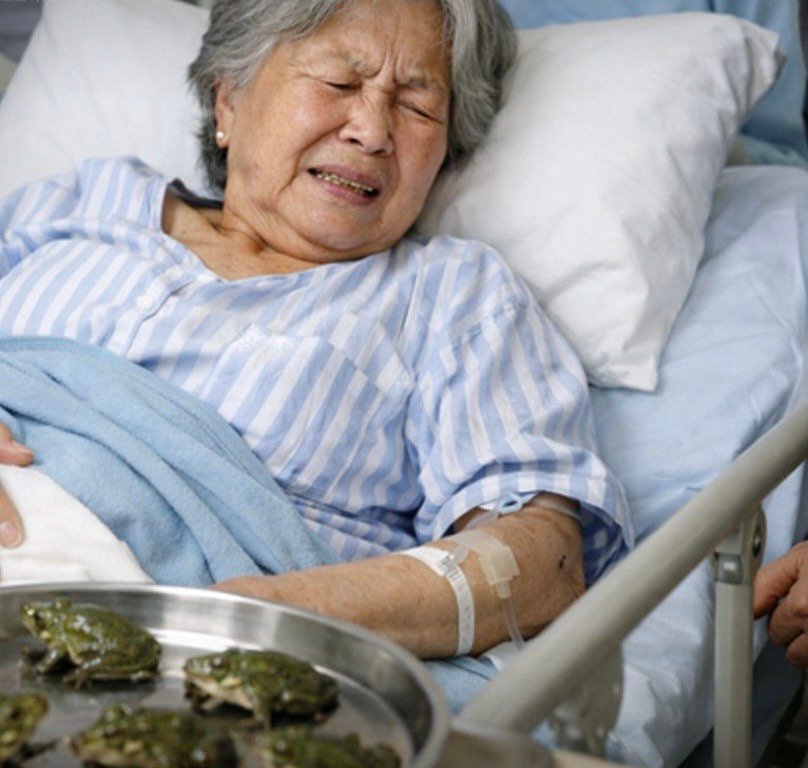 زن ۸۲ ساله در چین بخاطر درمان درد کمر هشت قوربقه زنده را بلعیدن