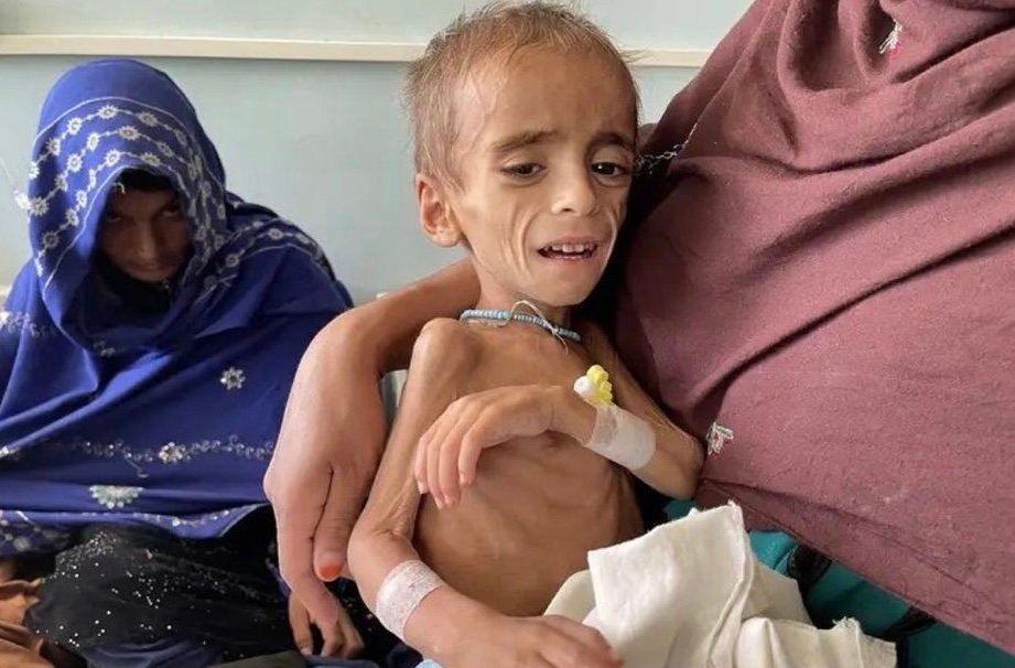 یونیسف از افزایش ۱۲ درصدی خطر مرگ کودکان افغانستانی خبر داد