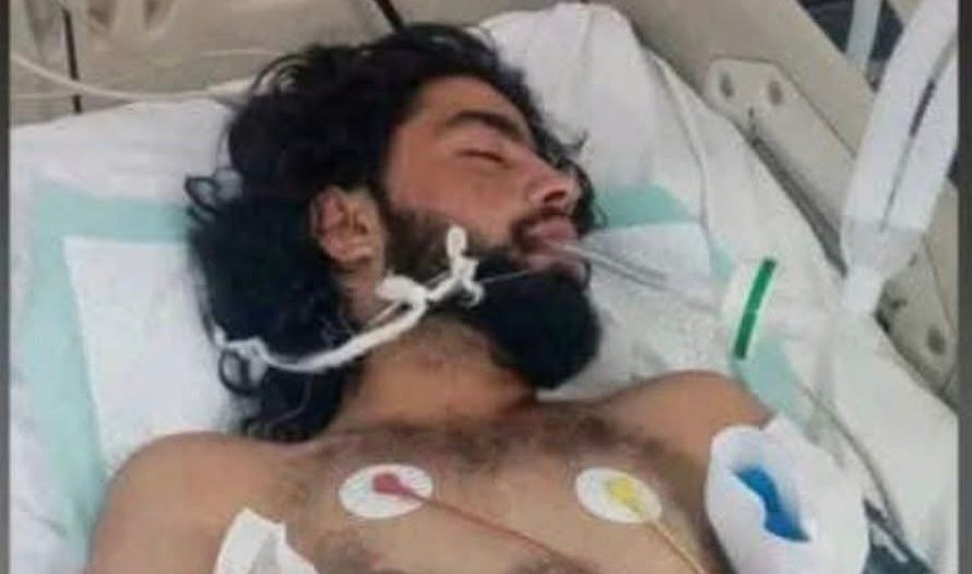 نظامی پیشین پولیس پس از شکنجه در بازداشت طالبان جان باخت